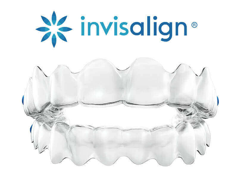 Invisaline Invisible Braces - Crossings Dental