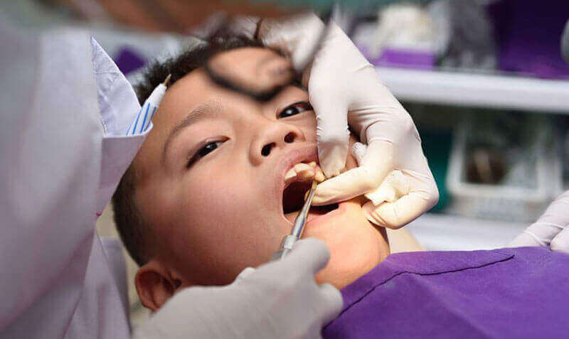 Tooth Extractions Stittsville